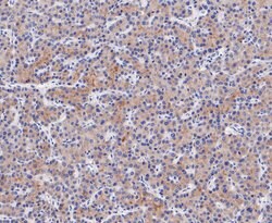 Invitrogen ENTPD5 Recombinant Rabbit Monoclonal Antibody (JE48-94) 100