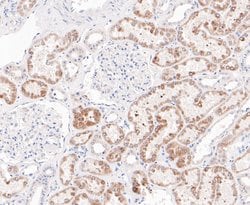 Invitrogen ENTPD5 Recombinant Rabbit Monoclonal Antibody (JE48-94) 100