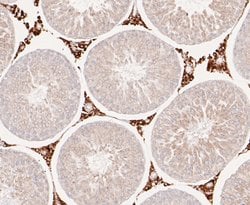 Invitrogen ENTPD5 Recombinant Rabbit Monoclonal Antibody (JE48-94) 100