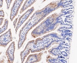 Invitrogen ENTPD5 Recombinant Rabbit Monoclonal Antibody (JE48-94) 100