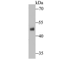 Invitrogen ENTPD5 Recombinant Rabbit Monoclonal Antibody (JE48-94) 100
