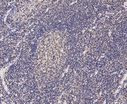 Invitrogen L-Plastin Recombinant Rabbit Monoclonal Antibody (JE48-95) 100 &mu;L | Buy Online | Invitrogen&trade; | Fisher Scientific