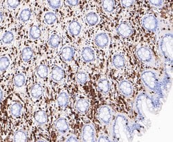 Invitrogen L-Plastin Recombinant Rabbit Monoclonal Antibody (JE48-95) 100 &mu;L | Buy Online | Invitrogen&trade; | Fisher Scientific