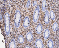 Invitrogen L-Plastin Recombinant Rabbit Monoclonal Antibody (JE48-95) 100 &mu;L | Buy Online | Invitrogen&trade; | Fisher Scientific