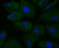 Invitrogen APRIL Recombinant Rabbit Monoclonal Antibody (JE49-07) 100 &mu;L;