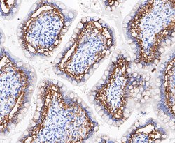 Invitrogen A33 Recombinant Rabbit Monoclonal Antibody (JE49-54) 100 &mu;L | Buy Online | Invitrogen&trade; | Fisher Scientific