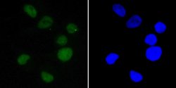 Invitrogen EWSR1 Recombinant Rabbit Monoclonal Antibody (JE49-57) 100 &mu;L;