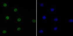 Invitrogen EWSR1 Recombinant Rabbit Monoclonal Antibody (JE49-57) 100 &mu;L;