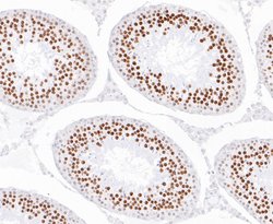 Invitrogen EWSR1 Recombinant Rabbit Monoclonal Antibody (JE49-57) 100 &mu;L;