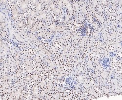 Invitrogen EWSR1 Recombinant Rabbit Monoclonal Antibody (JE49-57) 100 &mu;L;