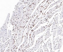 Invitrogen EWSR1 Recombinant Rabbit Monoclonal Antibody (JE49-57) 100 &mu;L;