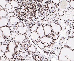 Invitrogen EWSR1 Recombinant Rabbit Monoclonal Antibody (JE49-57) 100 &mu;L;