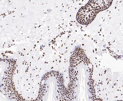 Invitrogen EWSR1 Recombinant Rabbit Monoclonal Antibody (JE49-57) 100 &mu;L;