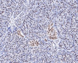 Invitrogen EWSR1 Recombinant Rabbit Monoclonal Antibody (JE49-57) 100 &mu;L;