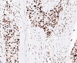 Invitrogen EWSR1 Recombinant Rabbit Monoclonal Antibody (JE49-57) 100 &mu;L;