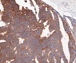 Invitrogen Lactoferrin Recombinant Rabbit Monoclonal Antibody (JE49-60)