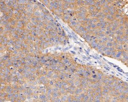 Invitrogen BCL2L12 Recombinant Rabbit Monoclonal Antibody (JE51-66) 100 &mu;L | Buy Online | Invitrogen&trade; | Fisher Scientific