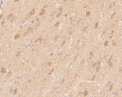 Invitrogen NEK7 Recombinant Rabbit Monoclonal Antibody (JE51-70) 100 &mu;L;