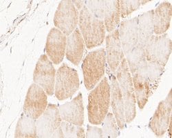 Invitrogen NEK7 Recombinant Rabbit Monoclonal Antibody (JE51-70) 100 &mu;L;