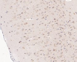 Invitrogen NUDC Recombinant Rabbit Monoclonal Antibody (JE50-74) 100 &mu;L;