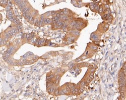 Invitrogen NUDC Recombinant Rabbit Monoclonal Antibody (JE50-74) 100 &mu;L;