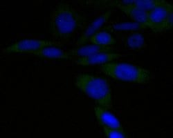 Invitrogen PSMA3 Recombinant Rabbit Monoclonal Antibody (JE51-59) 100 &mu;L;