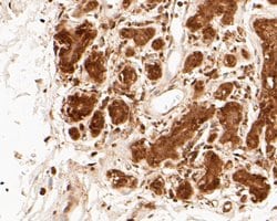 Invitrogen PSMA3 Recombinant Rabbit Monoclonal Antibody (JE51-59) 100 &mu;L;