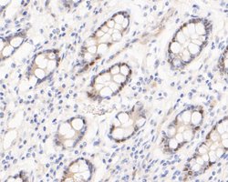 Invitrogen TIMELESS Recombinant Rabbit Monoclonal Antibody (JE51-39) 100