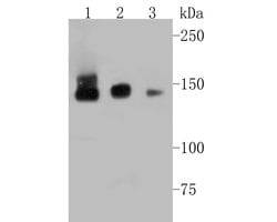 Invitrogen TIMELESS Recombinant Rabbit Monoclonal Antibody (JE51-39) 100