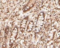 Invitrogen WAPL Recombinant Rabbit Monoclonal Antibody (JE51-75) 100 &mu;L;