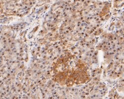 Invitrogen WAPL Recombinant Rabbit Monoclonal Antibody (JE51-75) 100 &mu;L;