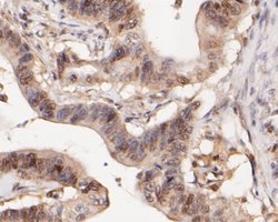 Invitrogen WAPL Recombinant Rabbit Monoclonal Antibody (JE51-75) 100 &mu;L;