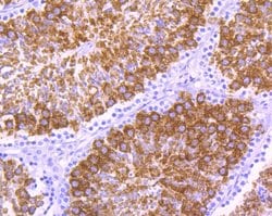Invitrogen YBX2 Monoclonal Antibody (A2-B9-G6) 100 &mu;L; Unconjugated:Antibodies,