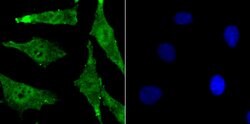 Invitrogen BMI-1 Monoclonal Antibody (A11-C11) 100 &mu;L; Unconjugated:Antibodies,