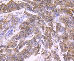 Invitrogen BMI-1 Monoclonal Antibody (A11-C11) 100 &mu;L; Unconjugated:Antibodies,