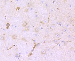 Invitrogen LNP Monoclonal Antibody (11-1) 100 &mu;L; Unconjugated:Antibodies,