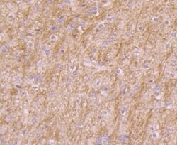 Invitrogen PI3K p85 alpha Monoclonal Antibody (L3-D6) 100 &mu;L | Buy Online | Invitrogen&trade; | Fisher Scientific