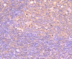 Invitrogen PI3K p85 alpha Monoclonal Antibody (L3-D6) 100 &mu;L | Buy Online | Invitrogen&trade; | Fisher Scientific