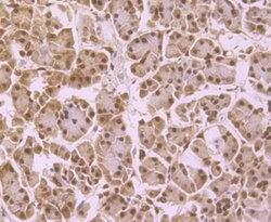 Invitrogen NFIB Monoclonal Antibody (1H2) 100 &mu;L | Buy Online | Invitrogen&trade; | Fisher Scientific