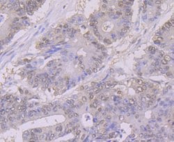 Invitrogen NFIB Monoclonal Antibody (1H2) 100 &mu;L | Buy Online | Invitrogen&trade; | Fisher Scientific