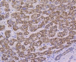 Invitrogen ALDH4A1 Monoclonal Antibody (7E3) 100 &mu;L; Unconjugated:Antibodies,