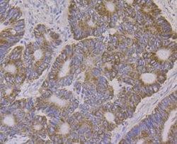 Invitrogen ALDH4A1 Monoclonal Antibody (7E3) 100 &mu;L; Unconjugated:Antibodies,