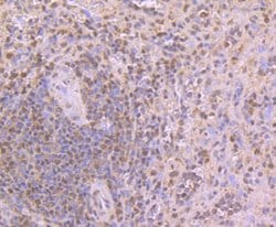 Invitrogen CUGBP1 Monoclonal Antibody (7A1) 100 &mu;L; Unconjugated:Antibodies,