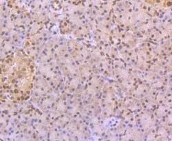 Invitrogen CUGBP1 Monoclonal Antibody (7A1) 100 &mu;L; Unconjugated:Antibodies,