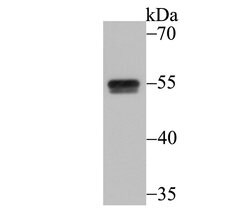 Invitrogen CUGBP1 Monoclonal Antibody (7A1) 100 &mu;L; Unconjugated:Antibodies,