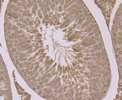 Thermo Scientific HSP701L Monoclonal Antibody (7D1):Antibodies, Monoclonal