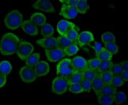 Invitrogen IL-31 Monoclonal Antibody (8-C3) 100 &mu;L; Unconjugated:Antibodies,