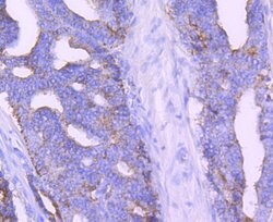 Invitrogen AMACR Monoclonal Antibody (6F5) 100 &mu;L; Unconjugated:Antibodies,