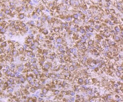 Invitrogen AMACR Monoclonal Antibody (6F5) 100 &mu;L; Unconjugated:Antibodies,