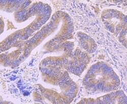 Invitrogen AMACR Monoclonal Antibody (6F5) 100 &mu;L; Unconjugated:Antibodies,
